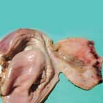 Паталого анатомические изменения при болени ньюкасла у кур
