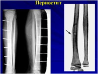 Периостит у животных