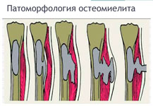 Остеомиелит у животных