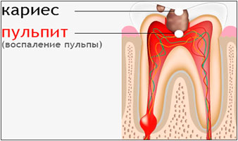 Пульпит у животных